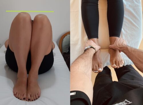 Ter uma perna menor que a outra é normal ou é comum? 