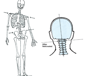 Disfunção em cervical alta