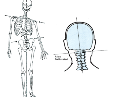 Disfunção em cervical alta